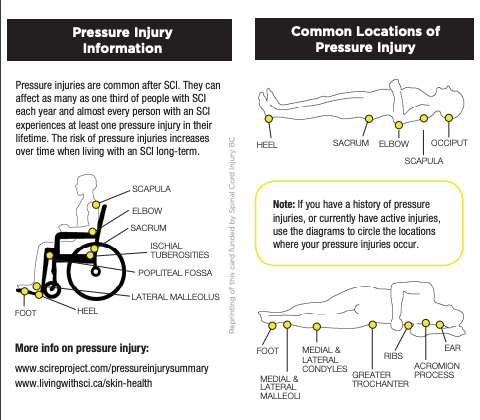 SCI Wallet Information Cards - Living With Spinal Cord Injury